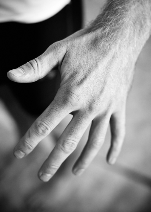 Problem med handen/händerna, Access Rehab.